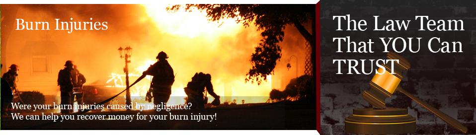 Burn Injuries Lawyer